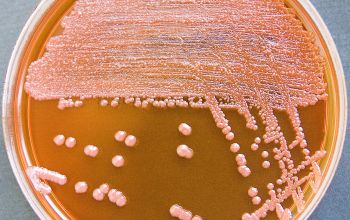 Acinetobacter baumannii Mac Conkey Agar without salt 48h culture incubated with O2