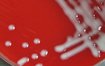 Acinetobacter baumannii Blood Agar 48h culture incubated with O2