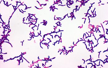 Actinomyces graevenitzii Gram stain