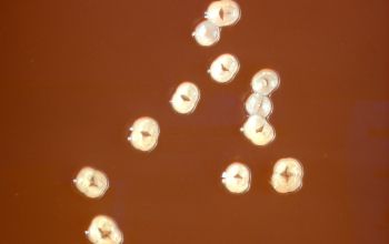 Actinomyces graevenitzii  culture incubated with CO2