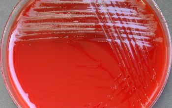 Actinomyces odontolyticus (Schaalia odontolytica) Blood Agar 24h culture incubated with CO2
