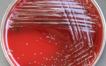 Actinomyces odontolyticus (Schaalia odontolytica) Blood Agar 48h culture incubated with CO2