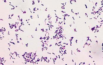 Schaalia turicensis  (Actinomyces turicensis) 