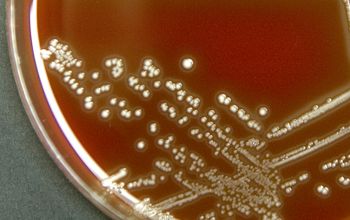 Aerococcus viridans Blood Agar 48h culture 