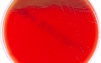 Alloscardovia omnicolens Blood Agar 24h culture incubated with CO2