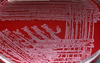 Arcanobacterium haemolyticum Blood Agar 48h culture incubated with CO2