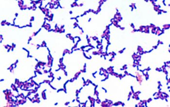Arcanobacterium haemolyticum Gram stain