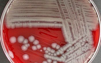 Bacillus anthracis Blood Agar 24h culture incubated with O2