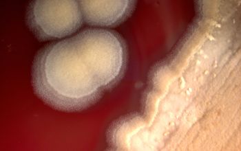 Bacillus anthracis Blood Agar 48h culture incubated with O2
