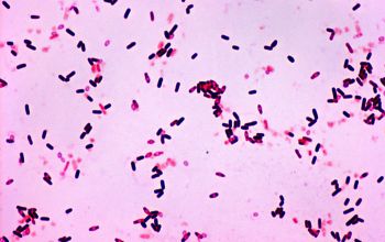 Bacillus lentus (Lederbergia lentus) Gram stain