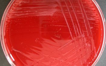 Bacillus lentus (Lederbergia lentus) Blood Agar 24h culture incubated with O2
