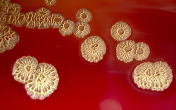 Bacillus pumilus  culture incubated with O2