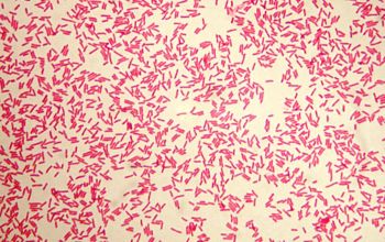 Bacteroides vulgatus (Phocaeicola vulgatus) Gram stain