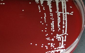 Brevibacterium casei Blood Agar 48h culture incubated with CO2