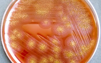 Capnocytophaga gingivalis Blood Agar 48h culture incubated with CO2
