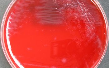 Capnocytophaga sputigena Blood Agar 24h culture incubated with CO2