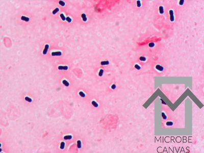 melanotan your body creates it Melanotan II - an overview