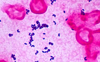 Corynebacterium accolens Gram stain
