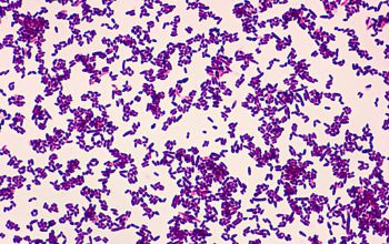 Corynebacterium amycolatum Gram stain
