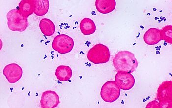 Corynebacterium amycolatum Gram stain