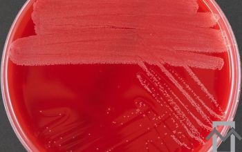 Corynebacterium jeikeium Blood Agar 48h culture incubated with CO2