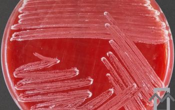 Corynebacterium jeikeium Blood Agar 48h culture incubated with CO2
