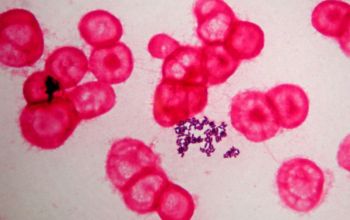 Corynebacterium jeikeium Gram stain