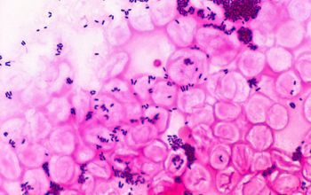 Corynebacterium jeikeium 