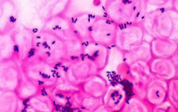 Corynebacterium jeikeium 