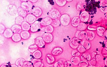 Corynebacterium jeikeium Gram stain