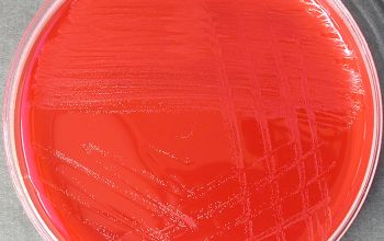 Corynebacterium jeikeium Blood Agar 24h culture incubated with CO2