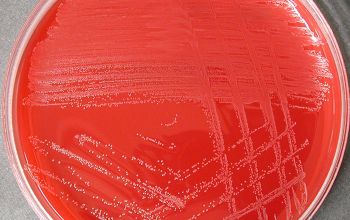 Corynebacterium jeikeium Blood Agar 48h culture incubated with CO2