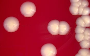 Corynebacterium striatum Blood Agar 48h culture incubated with O2