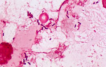 Enterobacter cloacae 