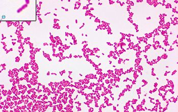 Escherichia coli Gram stain