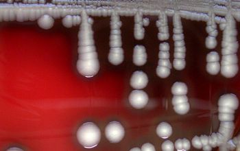 Escherichia coli Blood Agar 48h culture incubated with O2