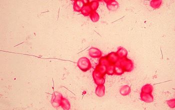 Fusobacterium nucleatum Gram stain