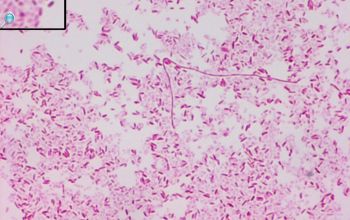 Fusobacterium varium Gram stain