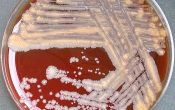 Gordonia bronchialis  culture incubated with O2