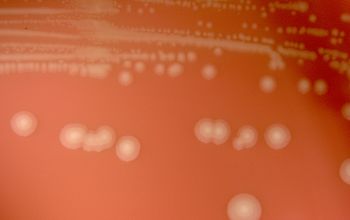 Haemophilus influenzae Chocolate Agar 24h culture incubated with CO2