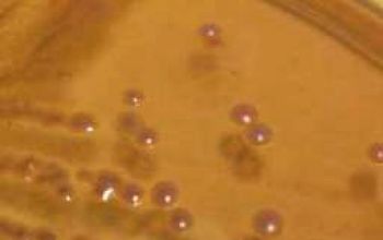 Kerstersia gyiorum Mac Conkey Agar without salt 48h culture incubated with CO2