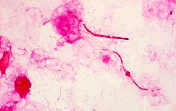 Klebsiella pneumoniae Gram stain