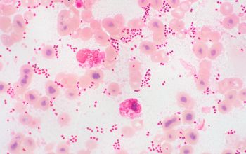 Klebsiella variicola Gram stain