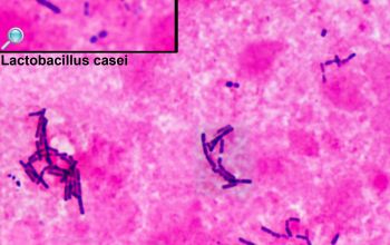 Lactobacillus casei Gram stain