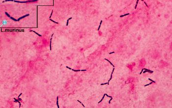 Lactobacillus murinus (Ligilactobacillus murinus) Gram stain