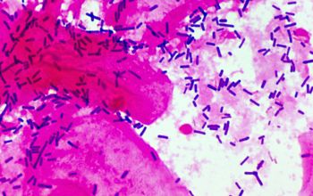 Lactobacillus rhamnosus (Lactocaseibacillus rhamnosum) Gram stain