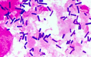 Lactobacillus rhamnosus (Lactocaseibacillus rhamnosum) Gram stain