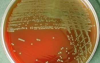 Lactobacillus salivarius (Ligilactobacillus salivarius) Blood Agar 48h culture incubated with CO2