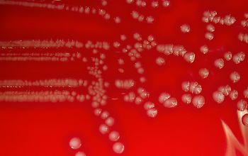Listeria ivanovii Blood Agar 24h culture incubated with CO2