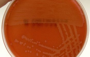 Listeria monocytogenes Blood Agar 24h culture incubated with CO2